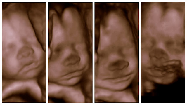 3d Ultrasound 29 Weeks2