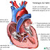 El corazón de Mariam