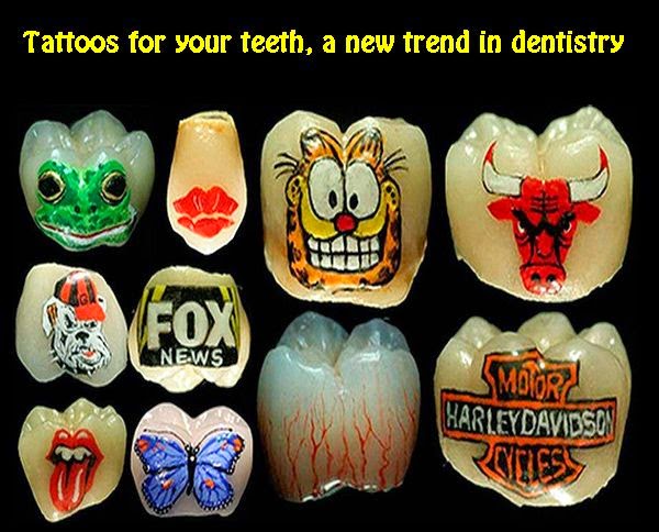 TATTOOS for your teeth, a new trend in dentistry 