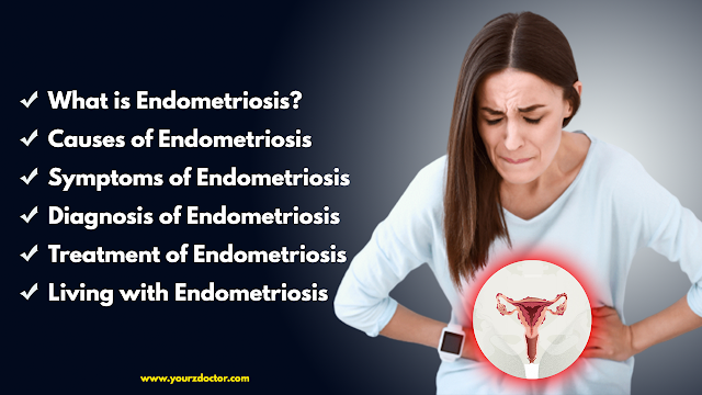 What is Endometriosis? | causes, symptoms, diagnosis, and treatment of endometriosis