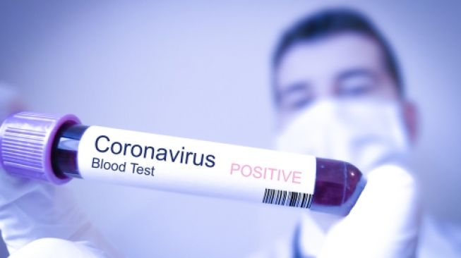 Ilmuwan Akhirnya Temukan Cara Memblokir Virus Corona agar Tidak Menginfeksi, naviri.org, Naviri Magazine, naviri majalah, naviri