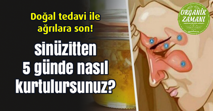 Sinüzitten 5 Günde Nasıl Kurtulursunuz?