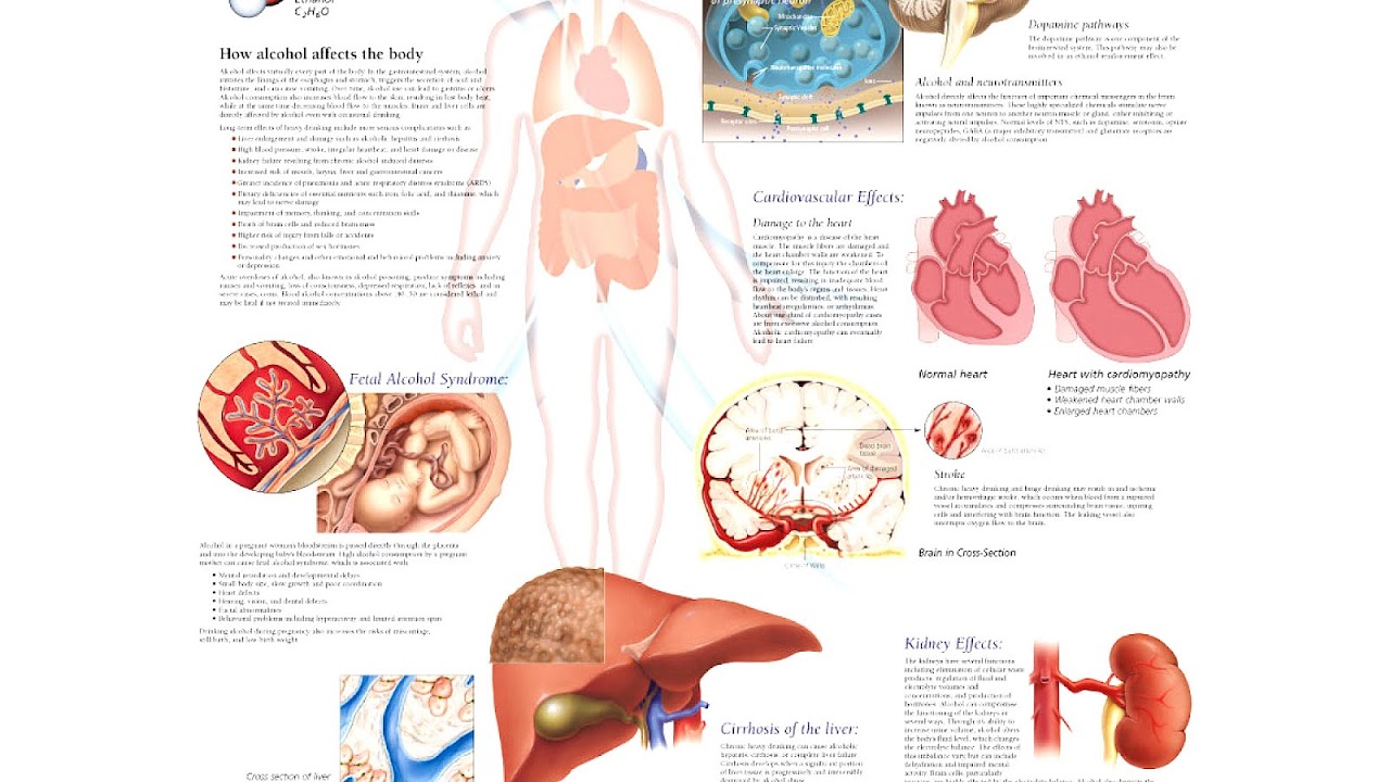 Short-term effects of alcohol consumption