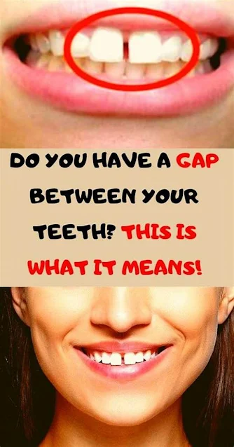 If You Have a Gap Between Your Teeth This is What it Means!