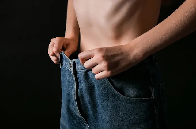 Kriteria Malnutrisi dan Cara Mengobatinya