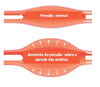 Resultado de imagem para Qual Ã© a probabilidade de vocÃª se tornar hipertenso?