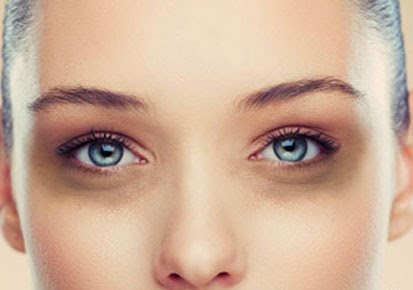 http://www.funmag.org/health-and-beauty-tips/treatment-for-dark-circles/