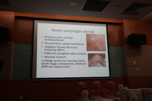 Ubat Eczema Orang Dewasa - Rawatan m