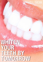 Who doesn't want bright, white teeth?