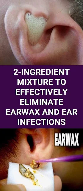 Get Rid Of Earwax And Ear Infections With ONLY 2 Ingredients!