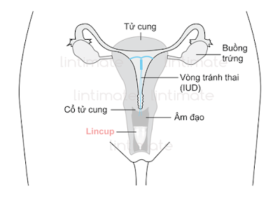 Review & So Sánh Cốc Nguyệt San Lincup và Skooncup, cốc nguyệt san, coc nguyet san, lincup, sckooncup, skooncup, nguyệt san, kinh nguyệt