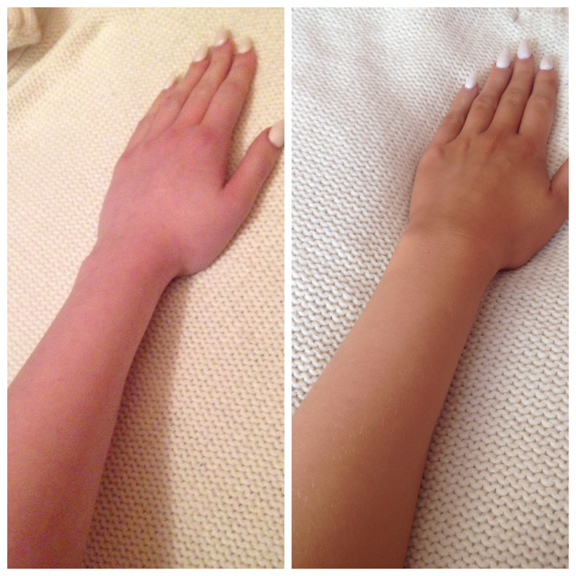 before tan (left) the following morning (right)