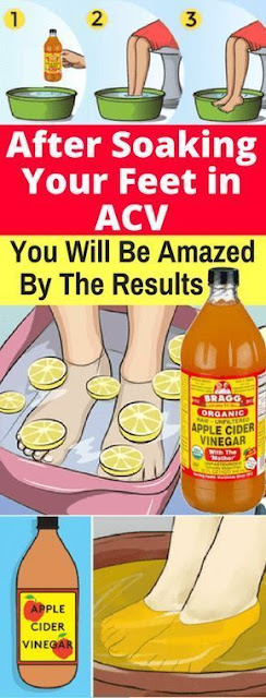 In the wake of Soaking Your Feet in ACV You Will Be Amazed By The Results