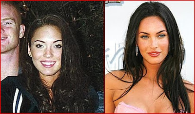 Megan Fox plastic surgery