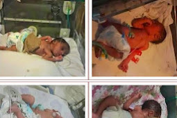 Miracle babies. LIB reader gives birth to quintuplets (5 babies) pics 