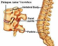 piringan tulang belakang vertebra