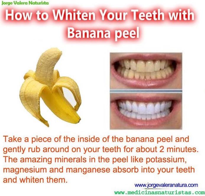 Do the banana peel routine twice daily to see teeth whiten.