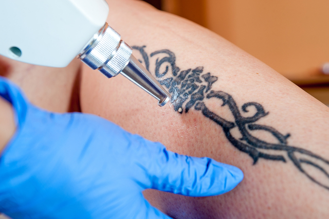 four Important Advances You Ought to Take While Pondering Getting A Tattoo!