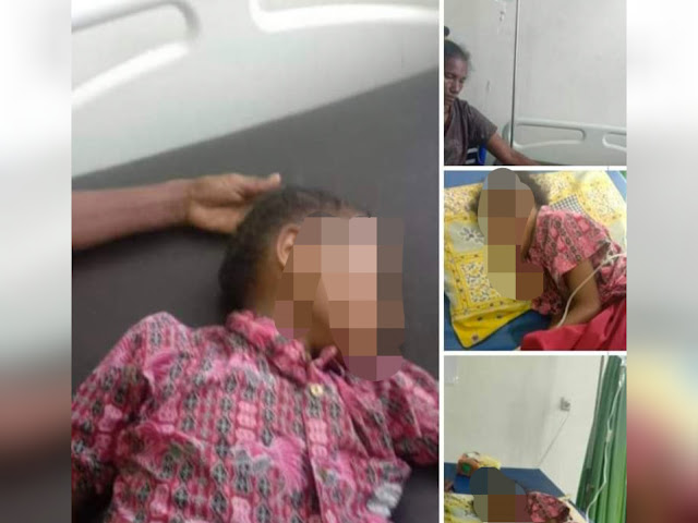 Heboh Penculikan Anak di Arso, Polisi Sebut Korban Kecelakaan Lalu Lintas