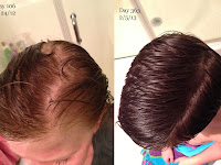49+ Castor Oil For Hair Growth Background