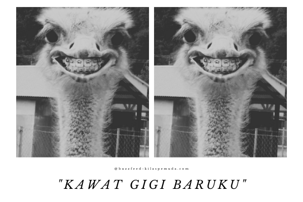 pamer kawat gigi