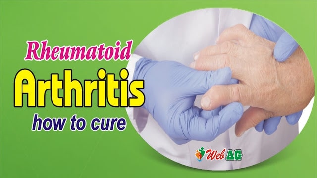 How To Cure Rheumatoid Arthritis Permanently