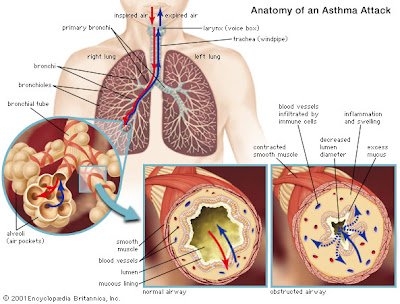 symptoms of asthma
