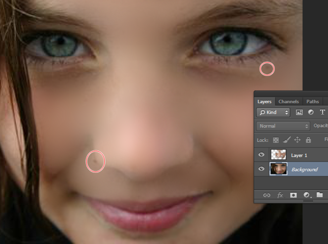 Menghilangkan Bintik Bintik Di Photoshop - 5 Cara Menghilangkan Milia Si Bintik Putih di Bawah Mata