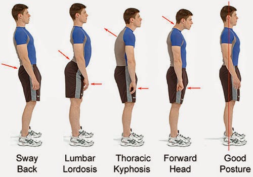 6 Bad Postures That Are Ruining Your Health & How To Correct Them