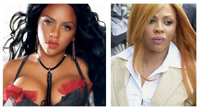 Lil Kim Plastic Surgery