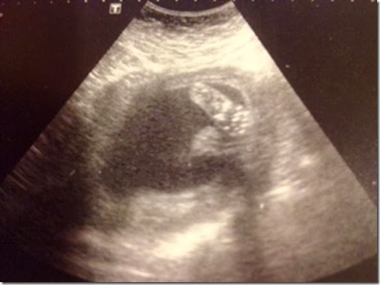 ultrasound 3
