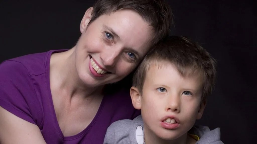 Isaac's Moebius Syndrome is a genetic hereditary disease.