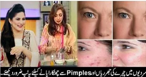 This is very easy way to remove pemples and Wrinkless in Winter season, how to remove, pimples and wrinkless in winter season, 