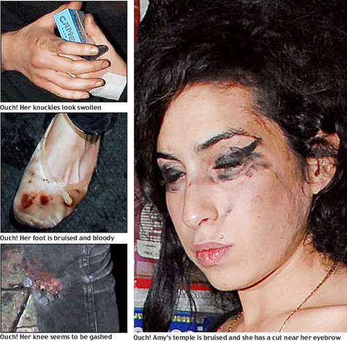 amy winehouse muerta