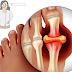 What is Gout Disease: Symptoms, causes, Diet, and Treatmen.