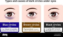 Types of black circles