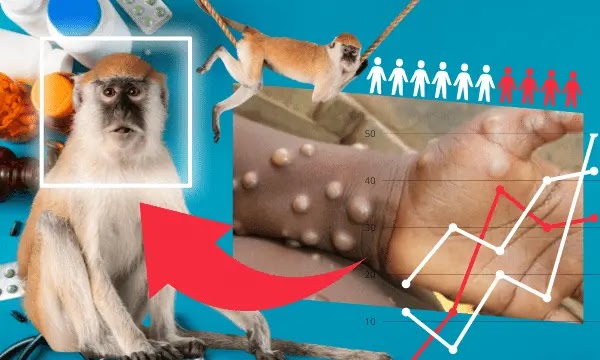 Monkeypox Be the Next Big Epidemic?