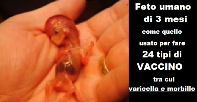 vaccini-fatti-con-cellule-di-feti-abortiti