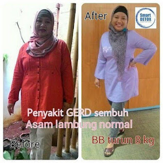 Jual Paket Lite Pack Smart Detox  di Area Banggai, Banggai Kepulauan SMS: +62813-1930-8376