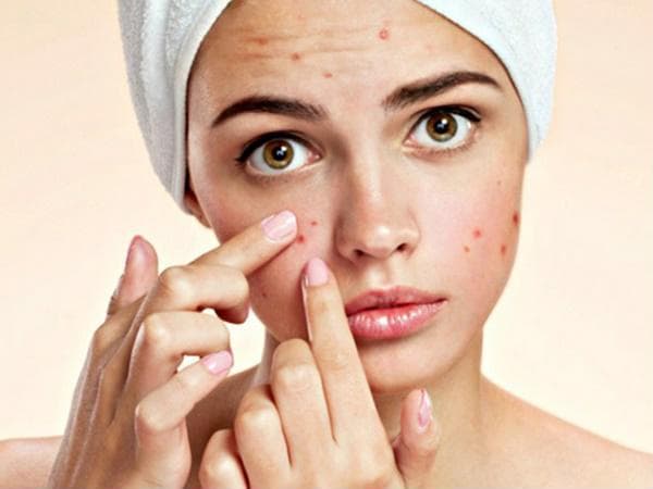 Cách chăm sóc da mặt không để lại thâm sau khi nặn mụn