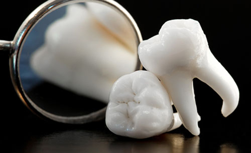 Răng khôn là răng hàm thứ 3 mọc cuối cùng trên cung hàm khi con người bước vào độ tuổi trưởng thành