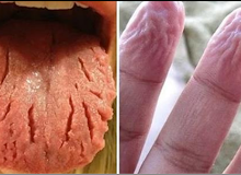 (MUST READ) SIXTEEN (16) SIGNS THAT SHOW YOU MAY HAVE HIV