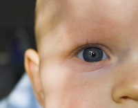 blood test for children with cataracts