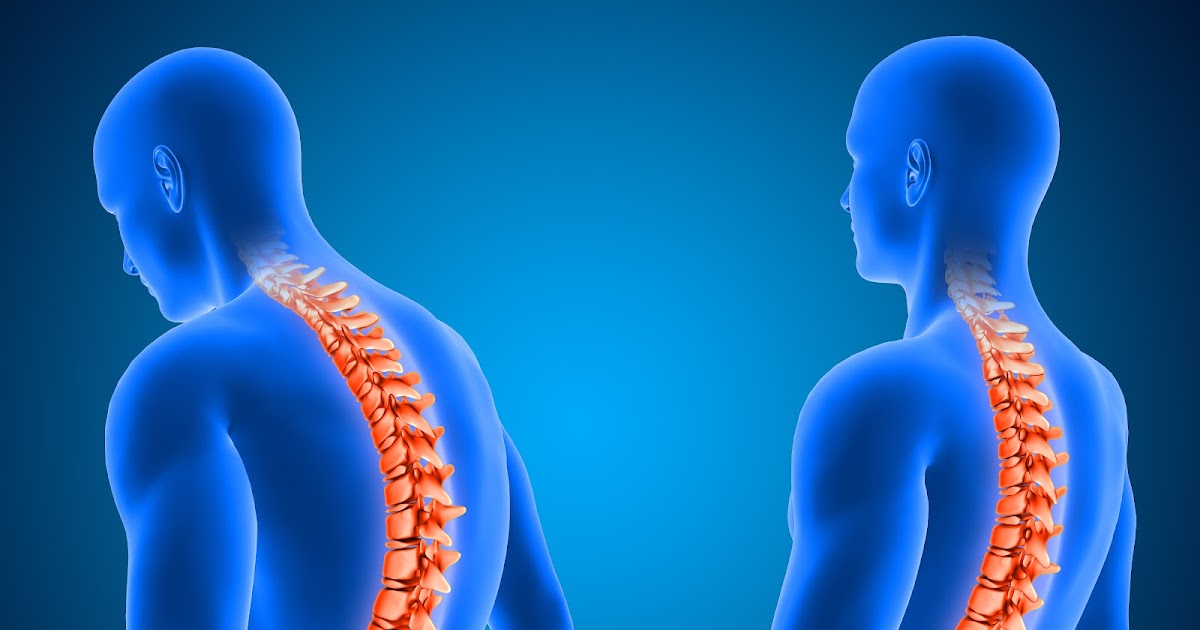 Exercises to improve posture and reduce back pain