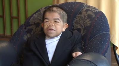 World's Shortest Man