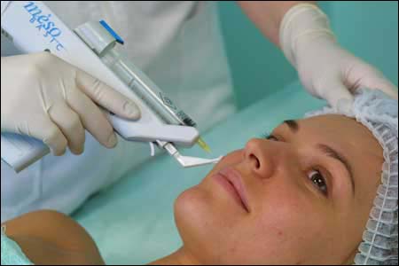 Laser Facial Hair Removal