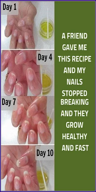 A Friend Gave Me This Recipe and My Nails Stopped Breaking and They Grow Healthy and Fast