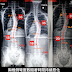 脊椎側彎矯正案例20- 治療10天胸椎側彎52度降為44度