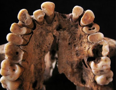 حفريات تافوغالت : أقدم أمراض الأسنان وجدت عند أسلاف الأمازيغ وهي مرتبطة بنمط تغذيتهم المتوارث