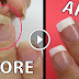 Best Nail Hack - How To Repair A Ripped Nail At Home